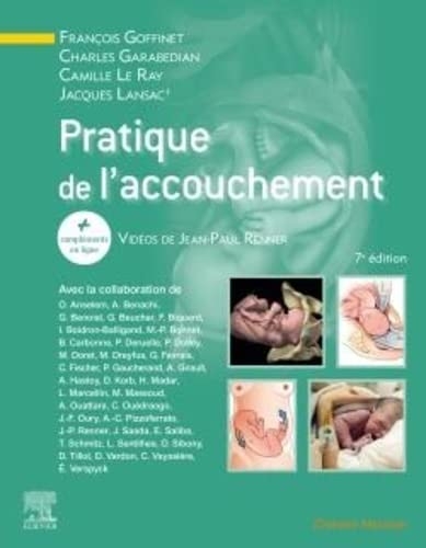 Pratique de l'accouchement