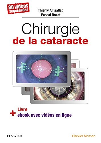 Chirurgie de la cataracte: 60 Videos Sequencees