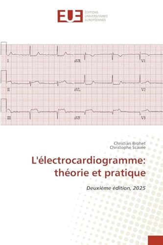 L'électrocardiogramme: théorie et pratique