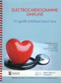 Electrocardiogramme simplifié : Un guide pratique pour tous