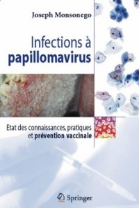 Infections a papillomavirus. : Etude des connaissances, pratiques et prevention vaccinale