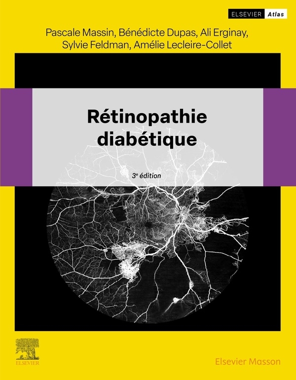 Rétinopathie diabétique