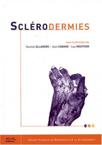 Sclérodermies