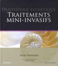 Dentisterie esthétique : traitements mini-invasifs: Traitement Mini-Invasifs