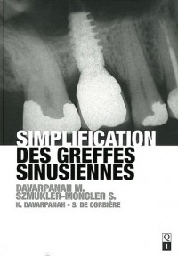 Simplification des greffes sinusiennes