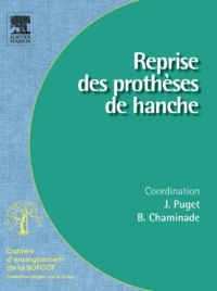 Reprise des prothèses de hanche