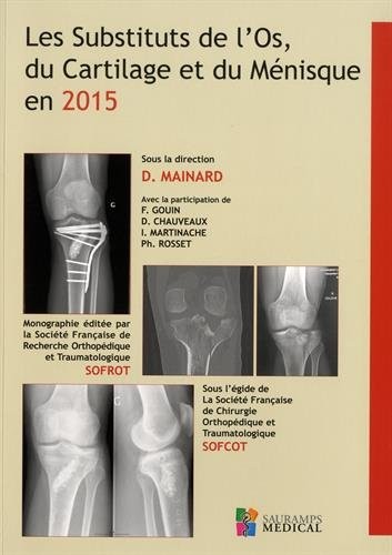 Les substituts de l'os, du cartilage et du ménisque en 2015