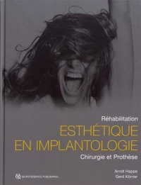 Réhabilitation esthétique en implantologie : Chirurgie et prothèse