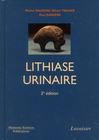 Lithiase urinaire