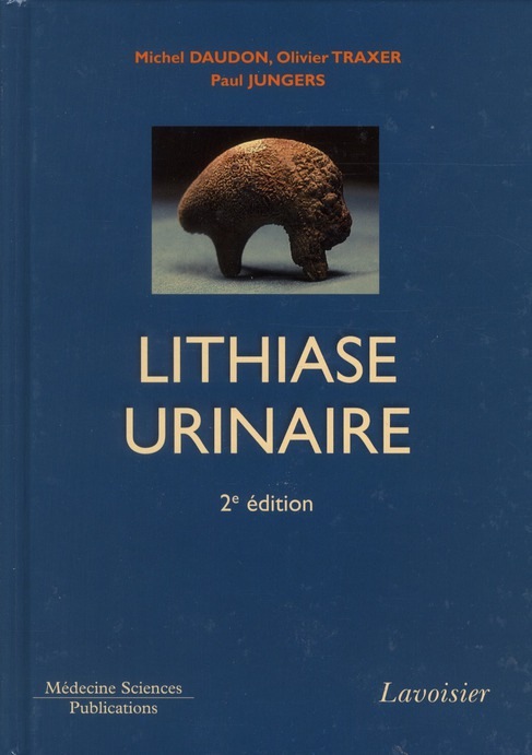 Lithiase urinaire