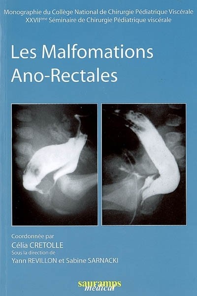 Les malformations Ano-Rectales : 27e séminaire de chirurgie pédiatrique viscérale