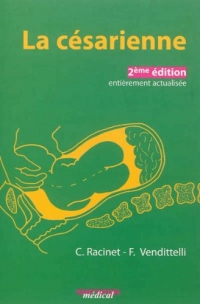 La césarienne: Une approche fondée sur les faits