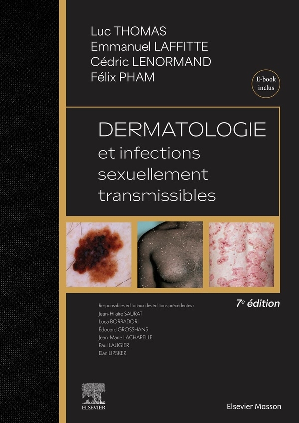 Dermatologie et infections sexuellement transmissibles: Avec ebook