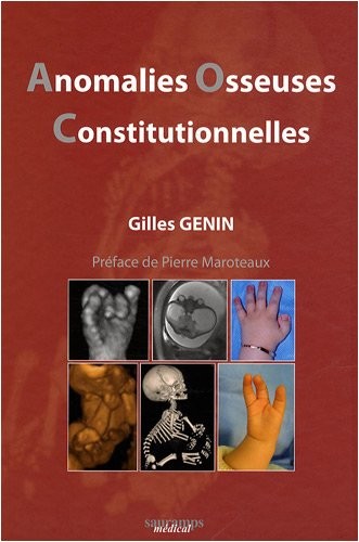 Anomalies osseuses consitutionnelles : Démarche pluridisciplinaire : obstétricale, pédiatrique, génétique, radiologique, génétique, radiologique, chirurgicale et psychologique