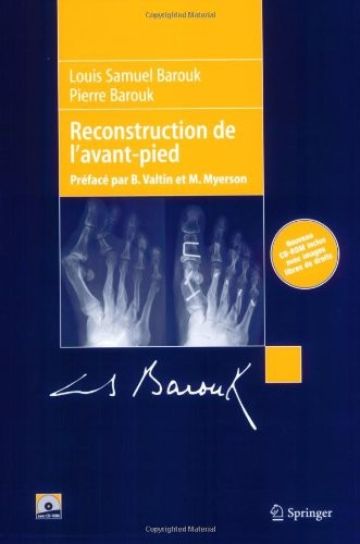Reconstruction de l'avant-pied