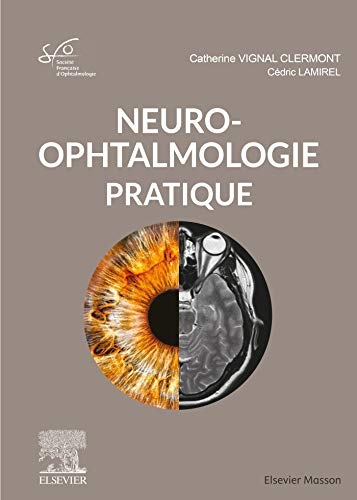 Neuro-ophtalmologie pratique: Rapport SFO 2020