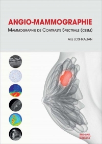 Angio-mammographie: Mammographie de contraste spectrale (CESM)