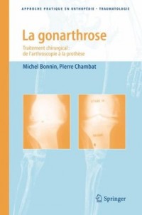 La gonarthrose : Traitement chirurgical : de l'arthroscopie à la prothèse