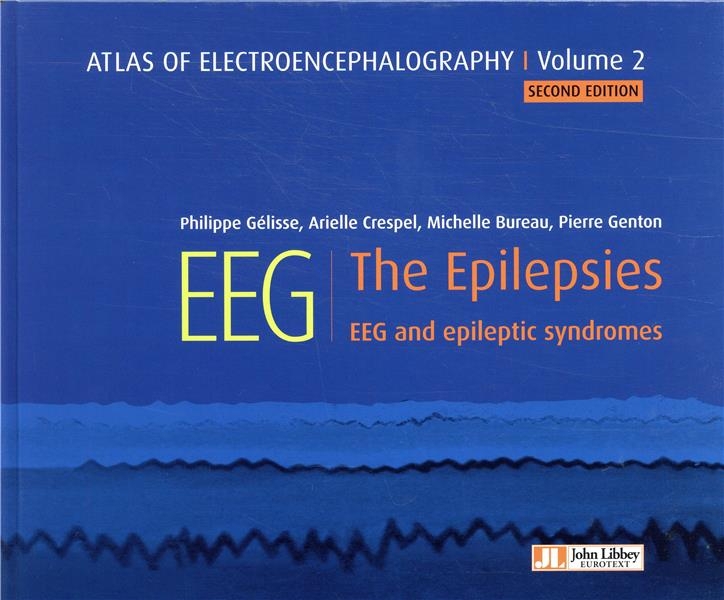 Atlas of Electroencephalography - Volume 2: The Epilepsies