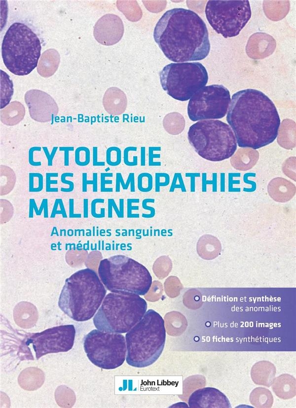 Cytologie des Hemopathies Malignes - Anomalies Sanguines et Medullaires