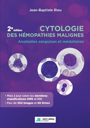 Cytologie des hémopathies malignes: Anomalies sanguines et médullaires