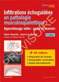 Infiltrations échoguidées en pathologie musculosquelettique: Apprentissage vidéo : geste et examen