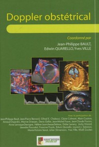 Doppler obstétrical