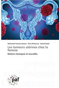 Les tumeurs utérines chez la femme