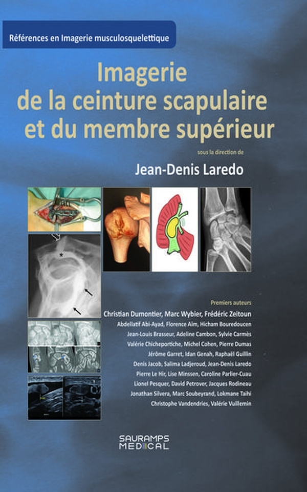 Imagerie de la ceinture scrapulaire et du membre supérieur