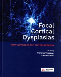 Focal Cortical Dysplasias: New advances for curing epilepsy
