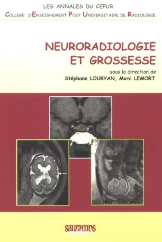 Neuroradiologie et grossesse