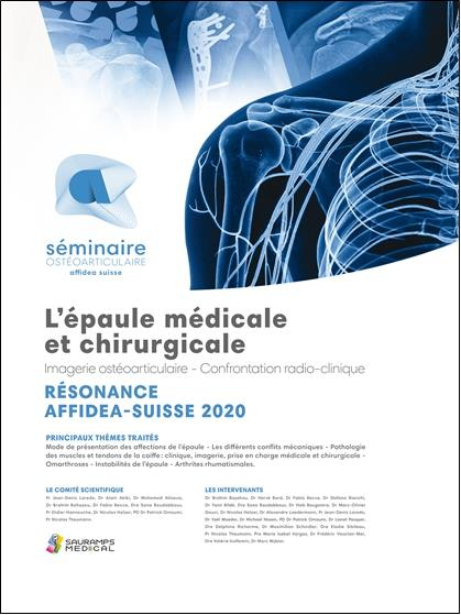 Résonance Affidea Suisse : L'épaule médicale chirurgicale