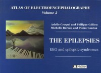 Atlas Of Electroencephalography Volume 2. The Epilepsies    Eeg And Epileptic Syndromes