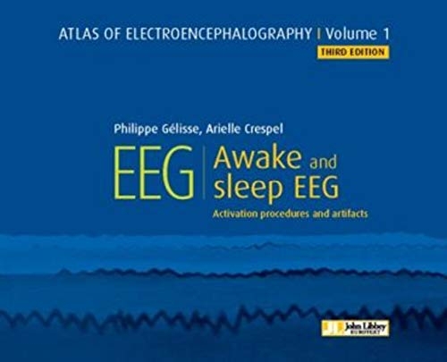Atlas of Electroencephalography - Volume 1: Awake and sleep EEG - Activation Procedures and Artifacts