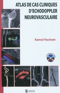 Atlas des cas cliniques d'échodoppler neurovasculaire