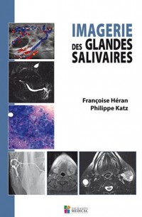 Imagerie des glandes salivaires