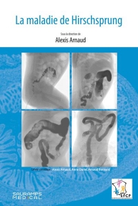 La maladie de Hirschsprung
