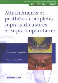 Attachements et prothèses complètes supra-radiculaires et supra-implantaires