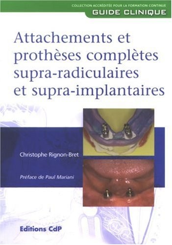 Attachements et prothèses complètes supra-radiculaires et supra-implantaires