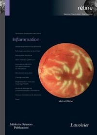 Rétine : Tome 4, Inflammation