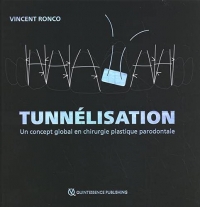 Tunnélisation: Un concept global en chirurgie plastique parodontale