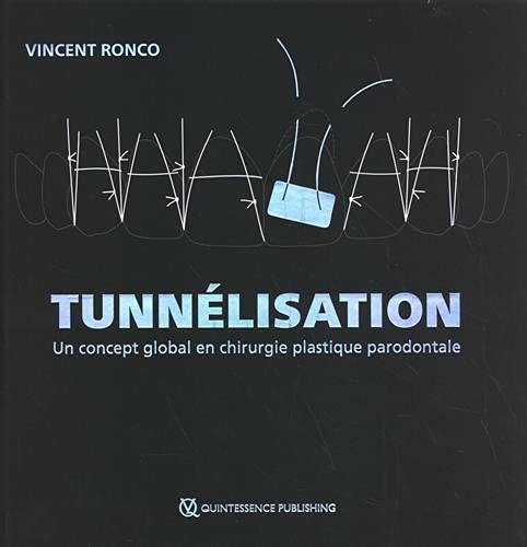 Tunnélisation: Un concept global en chirurgie plastique parodontale