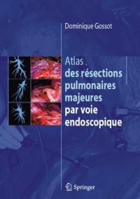 Atlas des résections pulmonaires majeures par voie endoscopique