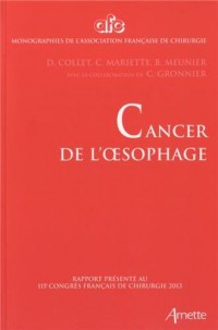 Cancer de l'oesophage : Rapport présenté au 115e Congrès français de chirurgie, Paris, 2-4 octobre 2013