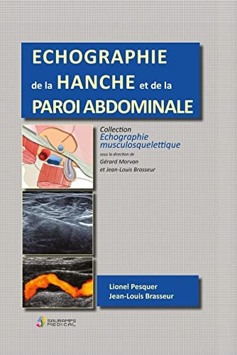 ECHOGRAPHIE DE LA HANCHE ET DE LA PAROI ABDOMINALE