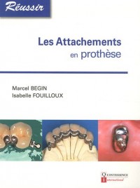 Les attachements en prothèse