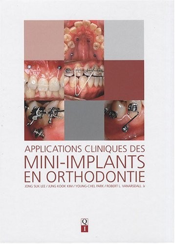 Applications cliniques des mini-implants en orthodontie