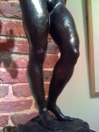 LA MALADIE VEINEUSE CHRONIQUE: DIAGNOSTIC ET STRATEGIE DE TRAITEMENT