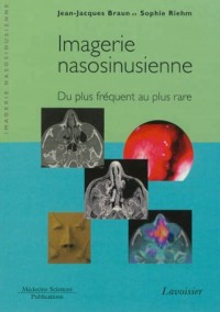 Imagerie nasosinusienne : Du plus fréquent au plus rare