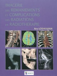 Imagerie des remaniements et complications des radiations en radiothérapie